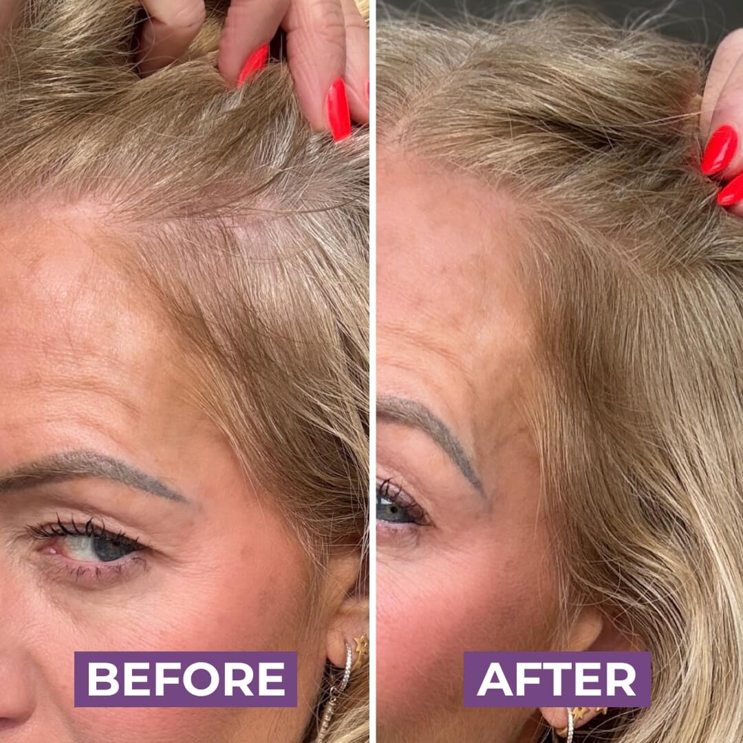 HairMagic+ Hairline Powder