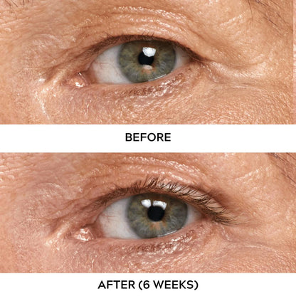 Best Lash Serum For Growth And Thickening