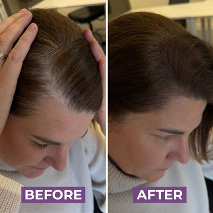 HairMagic+ Hairline Powder