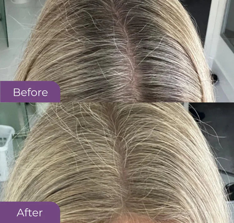 Before and after using HairMagic+ on blonde hair roots – natural grey root touch-up