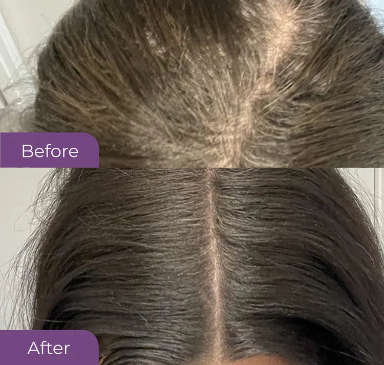Before and after using HairMagic+ on dark brown hair – concealing thinning hair and roots